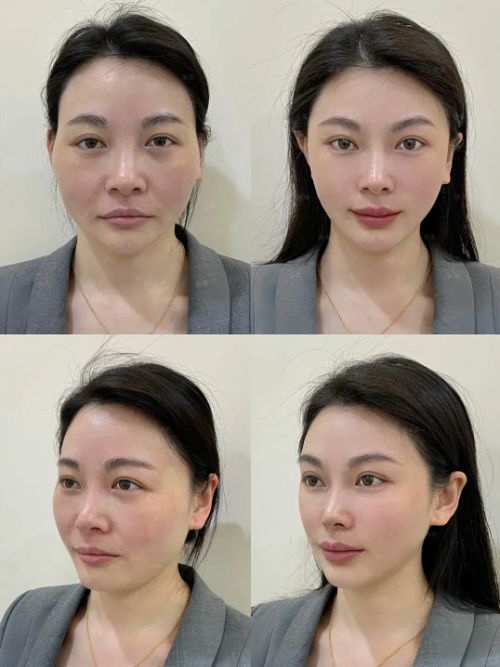 50岁抗皱紧致十大品牌给你紧致肌肤AG真人app抗衰老的护肤品排行榜(图4)